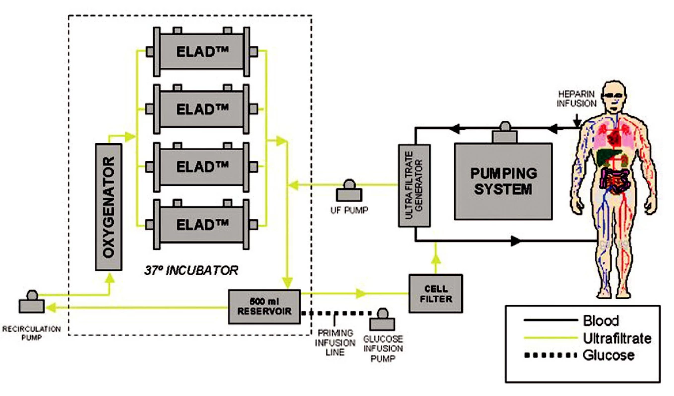 Schéma zapojení systému ELAD  (převzato z www.vitaltherapies.com).
Fig. 2. The ELAD system integration scheme  (adopted from www.vitaltherapies.com).
