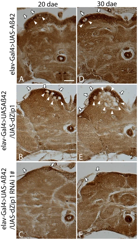 Forcible dZip1 expression modulation could alter Aβ42 accumulation in the brain.
