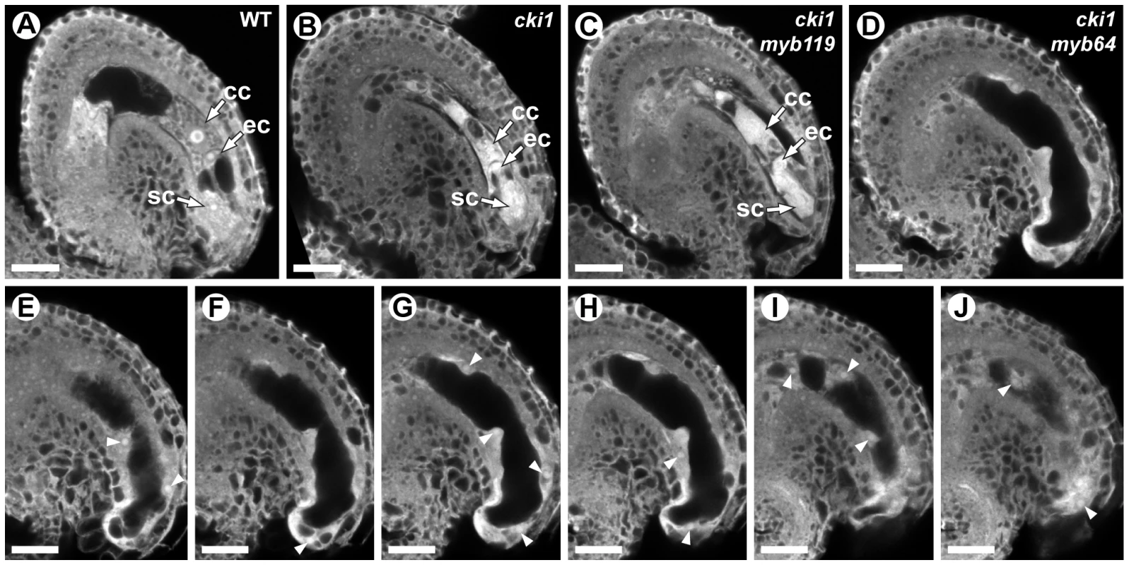 <i>cki1 myb64</i> double mutant gametophytes fail to initiate the FG5 transition.