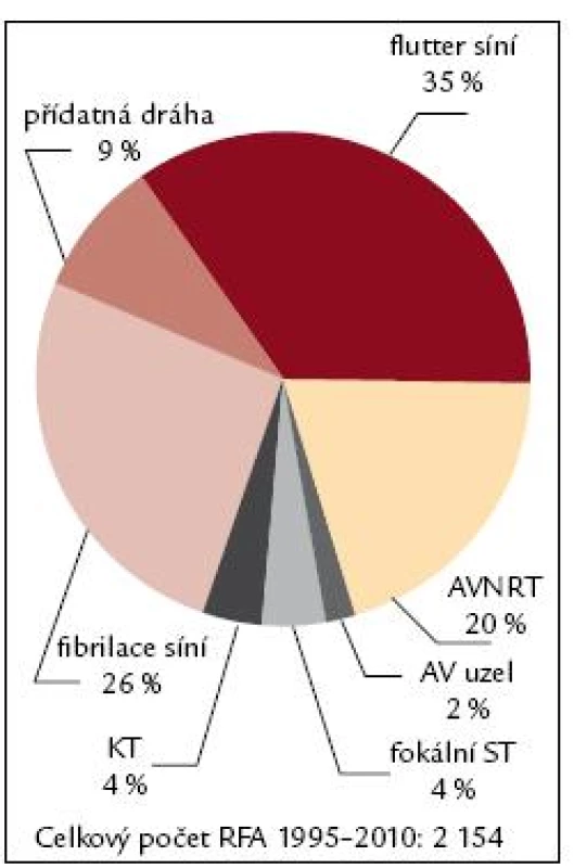 Spektrum RFA 2010.
Vysvětlivky viz. obr. 7.