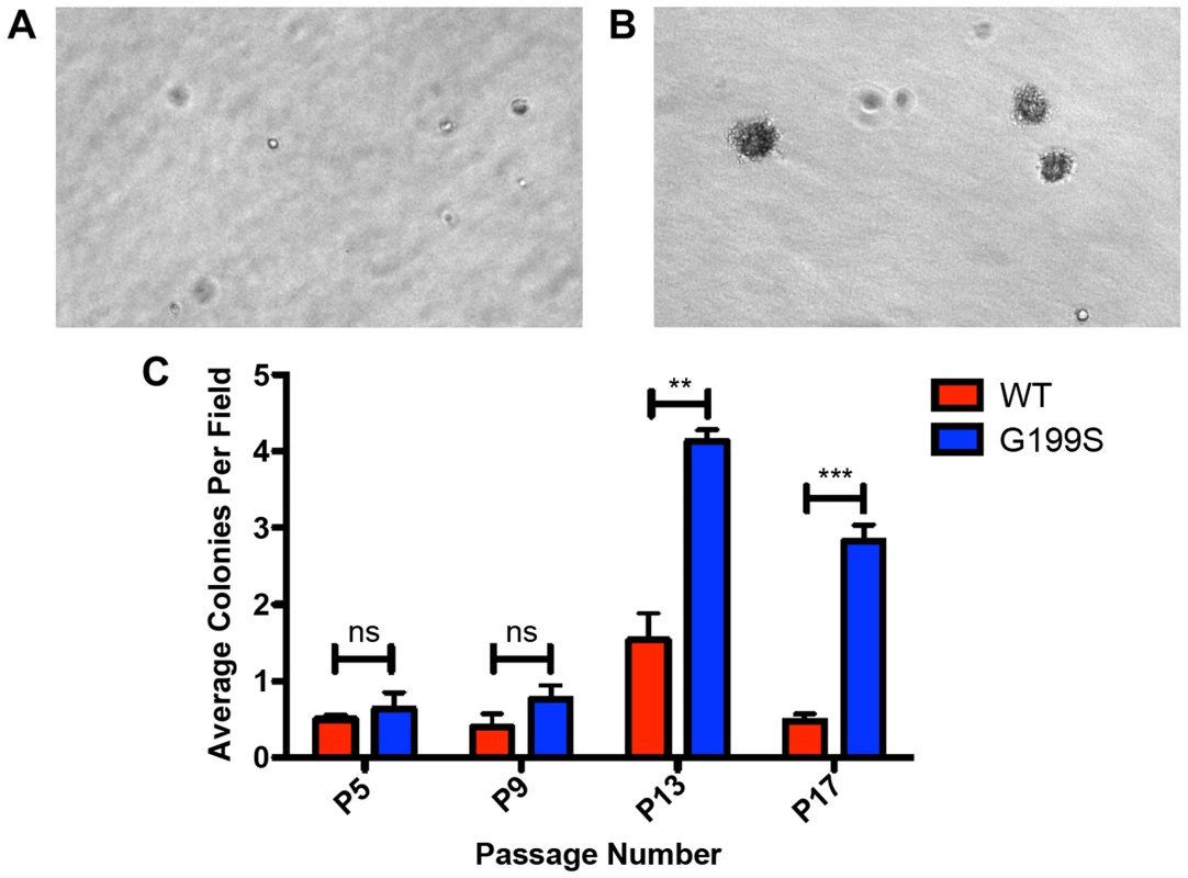 Expression of G199S induces cellular transformation.