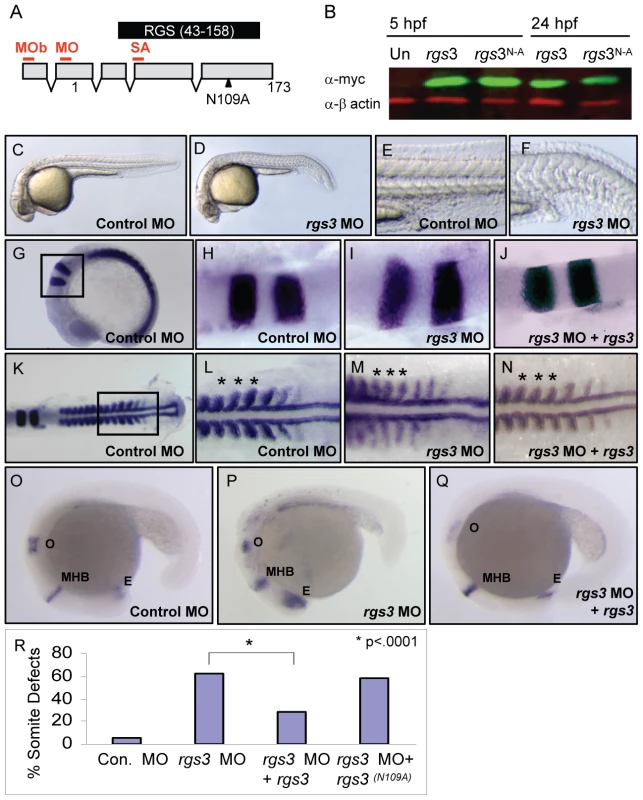 <i>rgs3</i> morphant phenotypes and functional rescue.