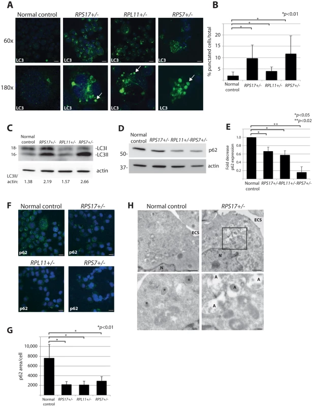 DBA mutations induce autophagy.