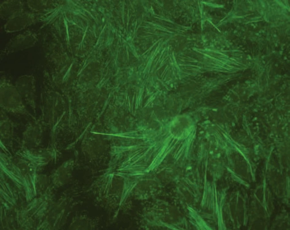Imunofluorescenční obraz protilátek proti aktinu (substrát – buněčná linie Hep-2).
Fig. 2. Immunofluorescent image of anti-actin antibodies (substrate – Hep-2 cell line).