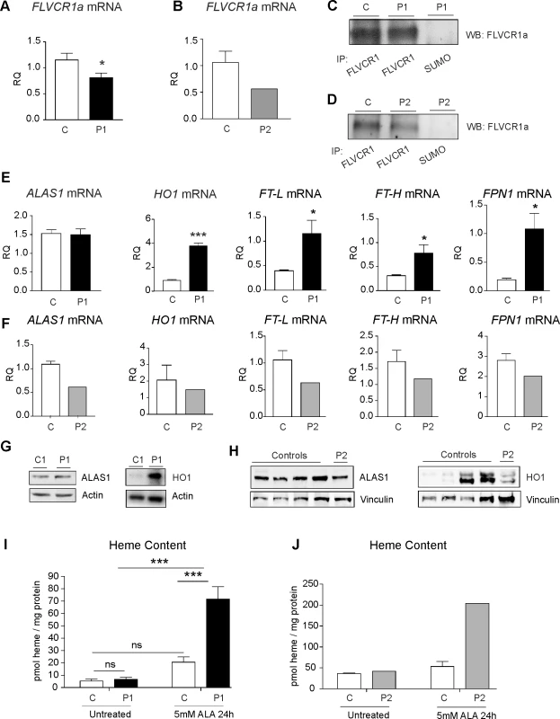 FLVCR1 mutations impair heme export in patient-derived cells.
