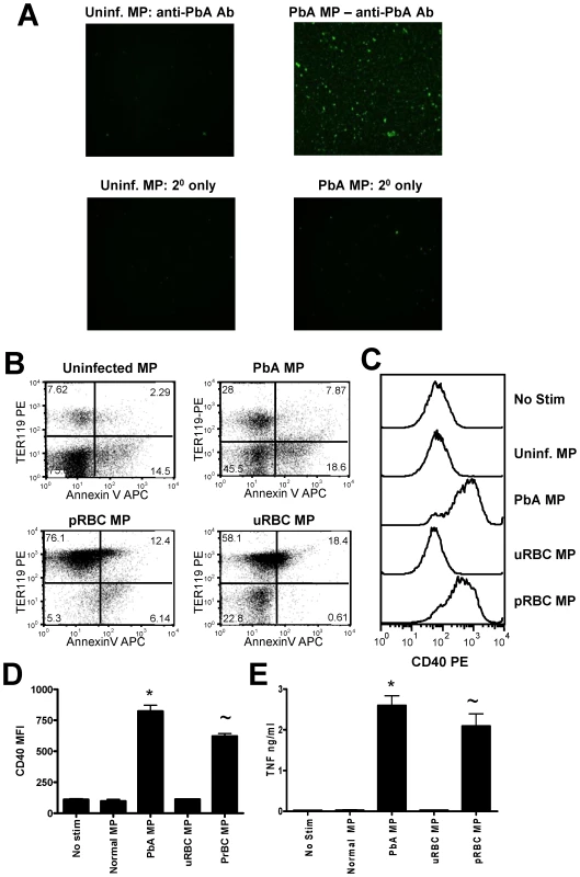 Immunogenic malaria infection-derived MPs are produced from pRBC and contain parasite materials.