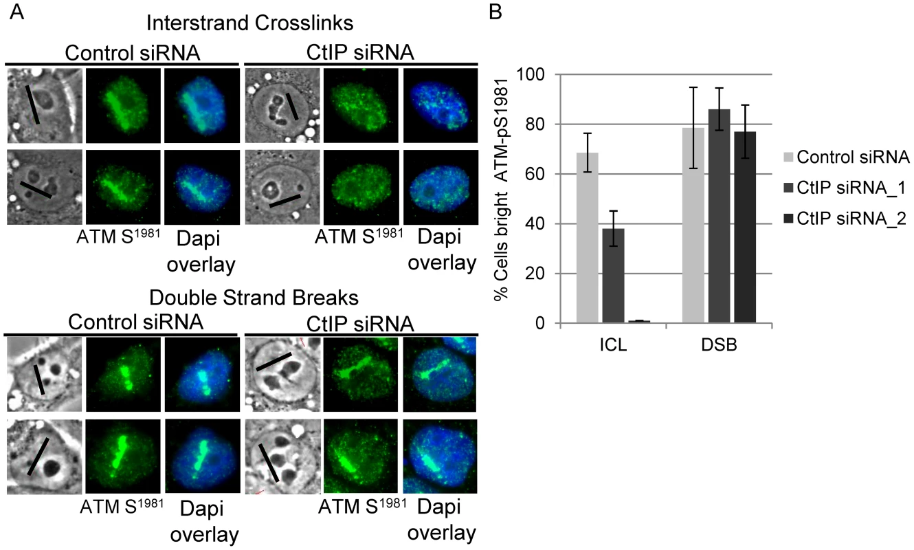 CtIP depletion reduces ATM-pS1981 at ICLs but not at DSBs.