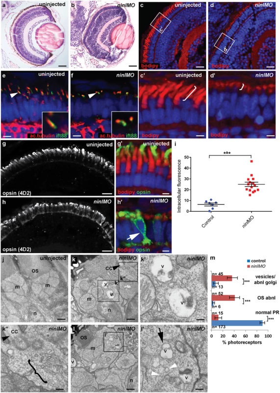 Zebrafish <i>ninl</i> knockdown causes loss of axonemes and outer segments, opsin mislocalization and vesicle/vacuole accumulation.
