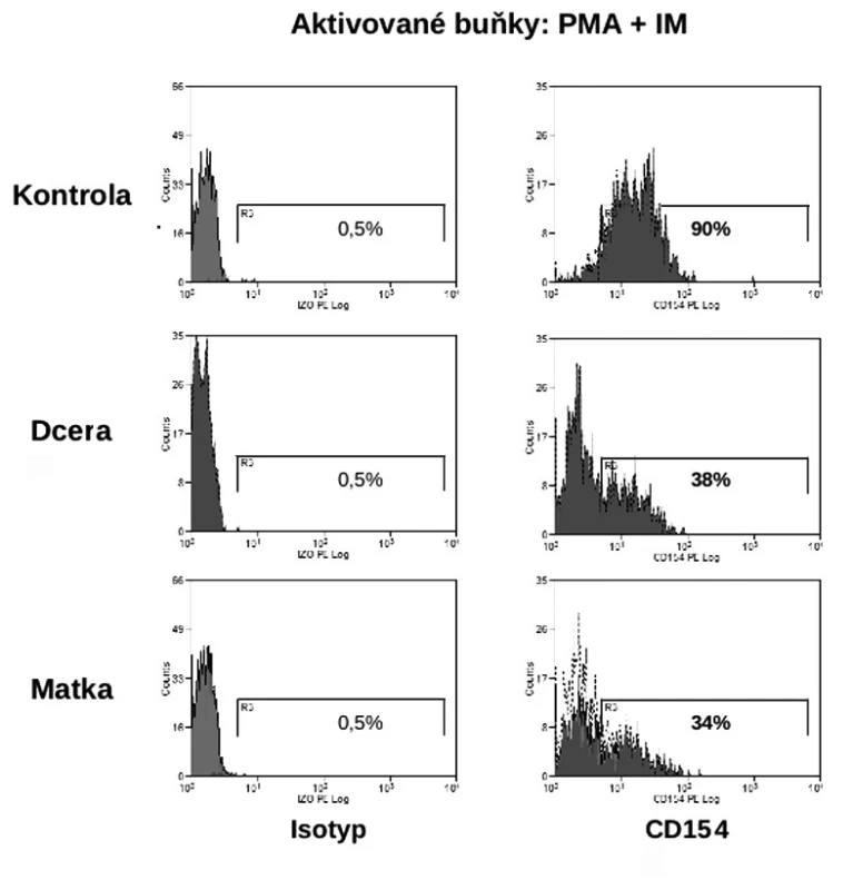 Záchyt přenašeček XHIGM (plná krev, aktivované buňky)
Fig. 4. Capture of XHIGM carriers (whole blood, activated cells)