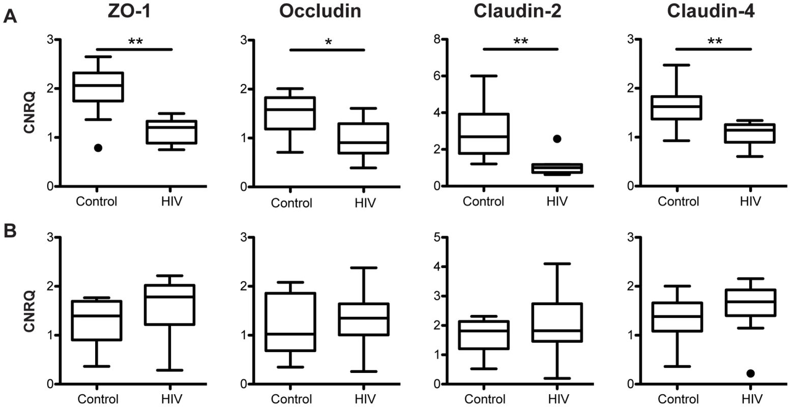 Tight junctional transcripts are decreased in the colon, not the terminal ileum, of HIV+ individuals.