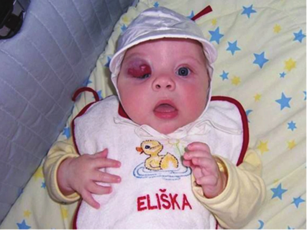 Smíšený IH