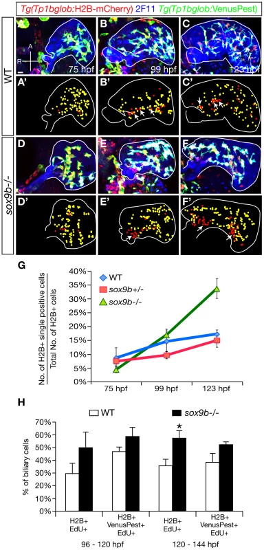 The pattern of Notch signaling activity is altered in <i>sox9b</i> mutants.
