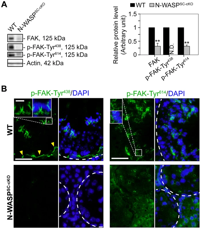 Modifications in the localization and expression patterns of the ES regulatory protein FAK and its phosphorylated forms in N-WASP<sup>SC-cKO</sup> tubules.