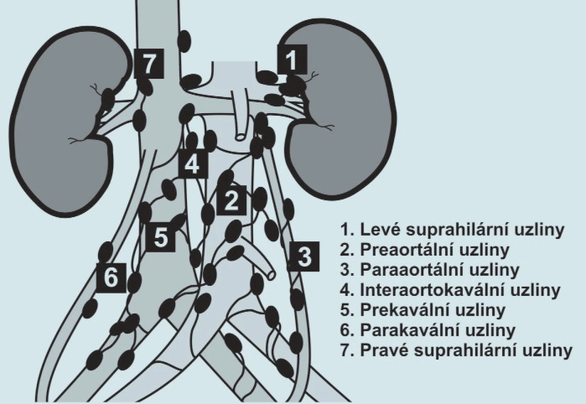 Schematické rozdělení nodi lymphatici lumbales.