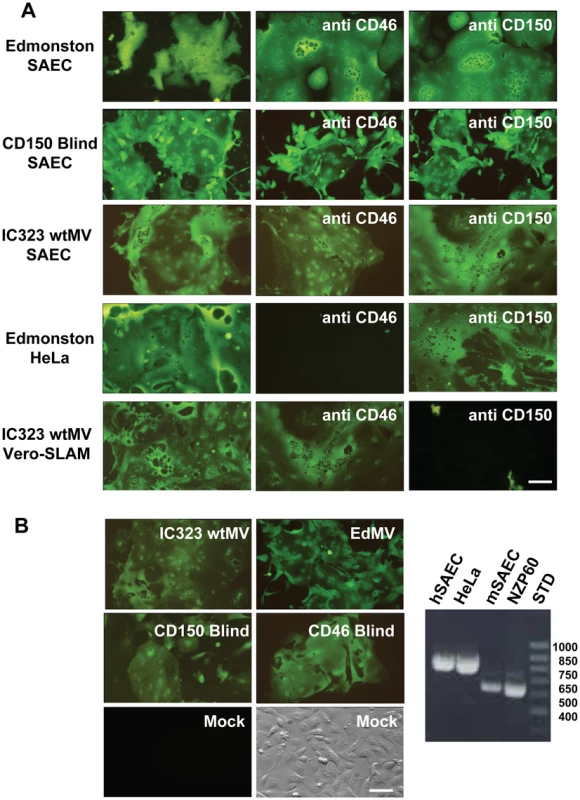 A new receptor for MV is present on smooth airway epithelial cells (SAEC).