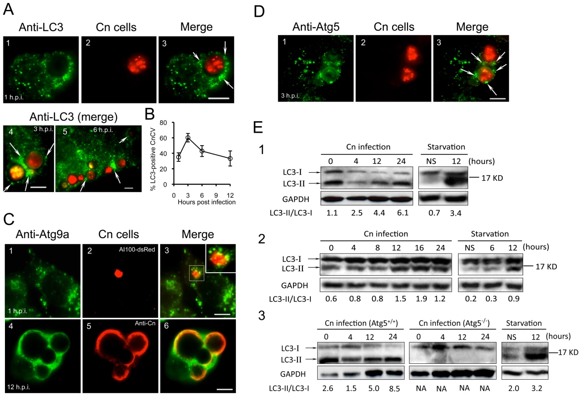 <i>Cryptococcus neoformans</i> interactions with Atg proteins during infection.