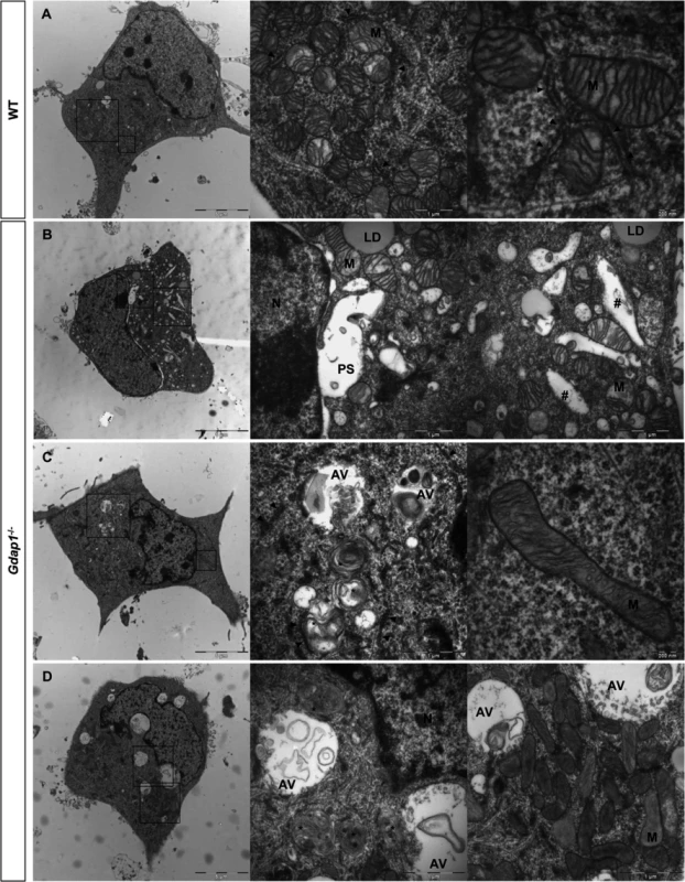 Ultrastructural analysis of embryonic motor neurons.