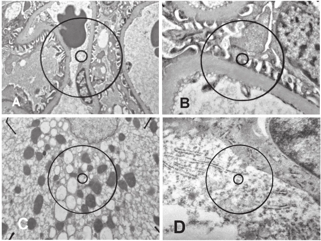 Elektronogramy renálních glomerulů <b>(A, B)</b> a hepatocytu <b>(C)</b> po kontrastování ultratenkých řezů manganistanem draselným a octanem olova. Neuron s denzním oligodendrogliovým satelitem <b>(D)</b> po kontrastování taninem a octanem olova.