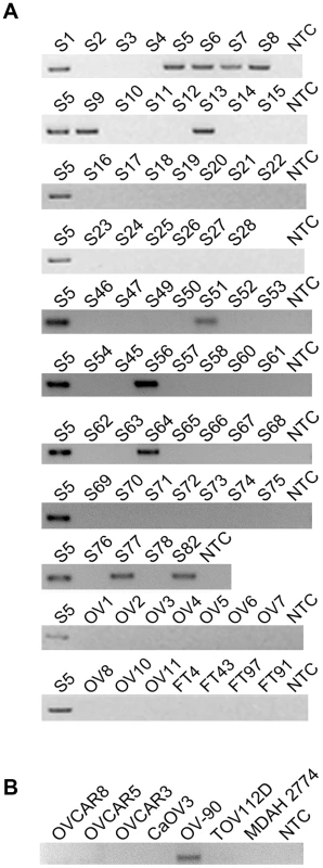 <i>CDKN2D-WDFY2</i> is a highly frequent fusion transcript in HG-SC cancer samples and cell line.
