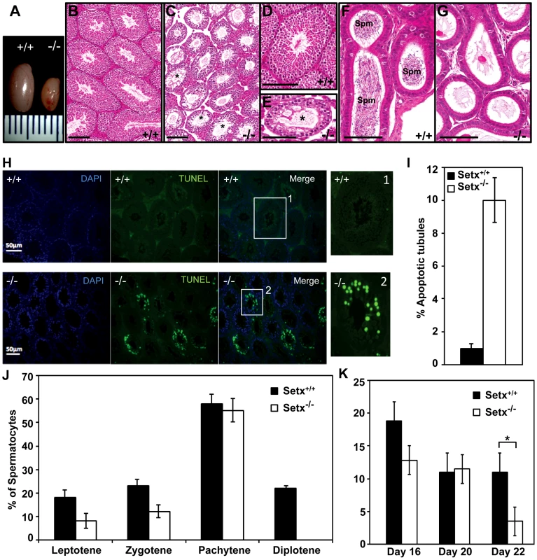 Spermatogenesis is disrupted in <i>Setx<sup>−/−</sup></i> mice.