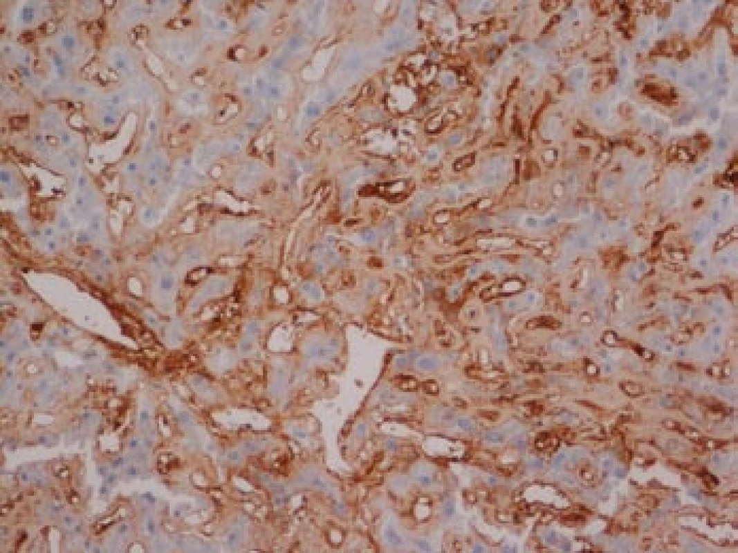 Játra, imunohistochemie.