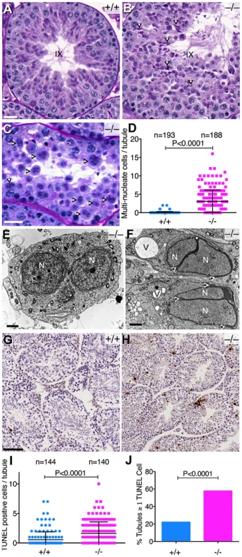 Abnormal spermatogenesis in the absence of <i>Baz1a</i>.