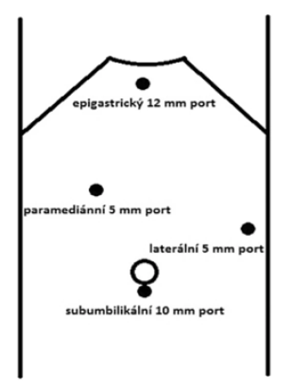 Rozložení portů<br>
Fig. 1: Port positions