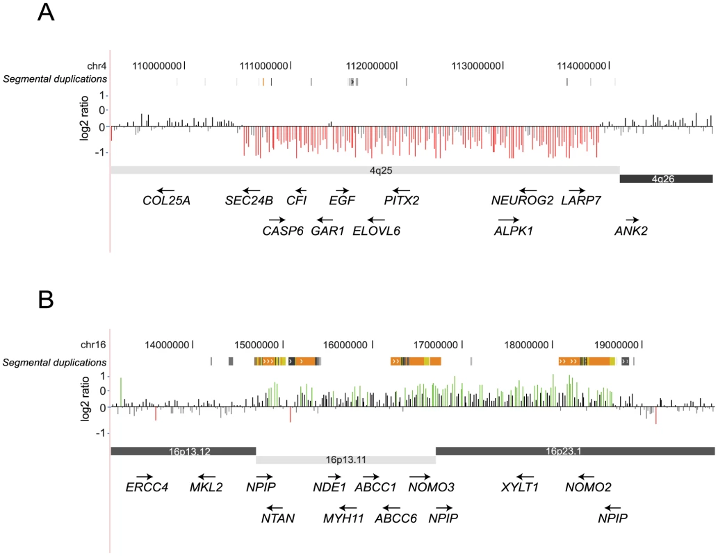 Two large CNV hits in a case with ID/MCA.