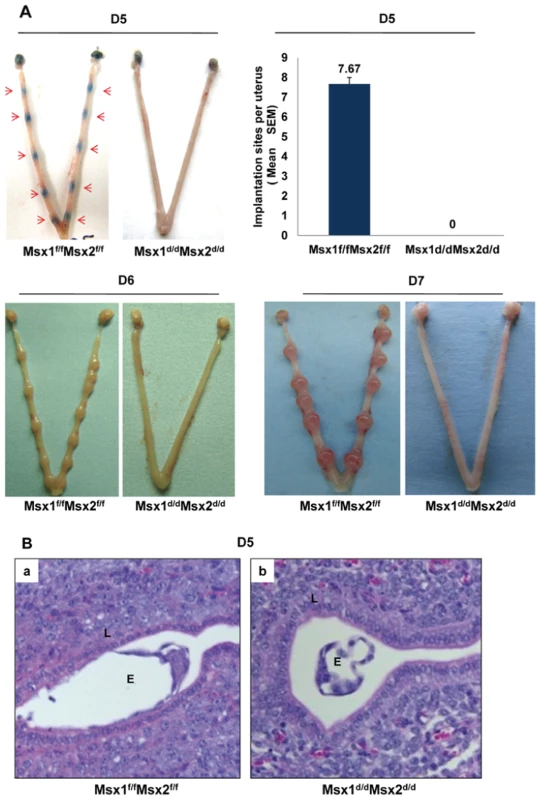 Lack of uterine <i>Msx</i>1 and <i>Msx</i>2 causes implantation failure.