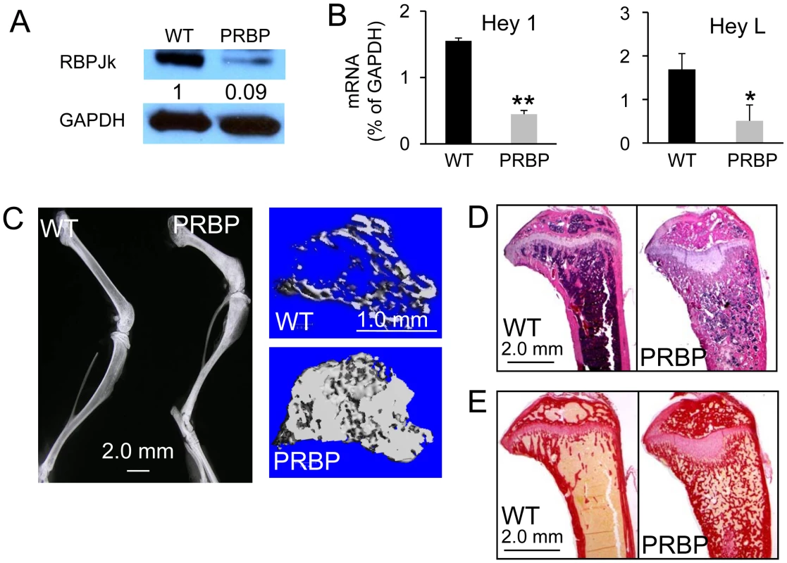 Bone mass of PRBP mice at 8 weeks of age.