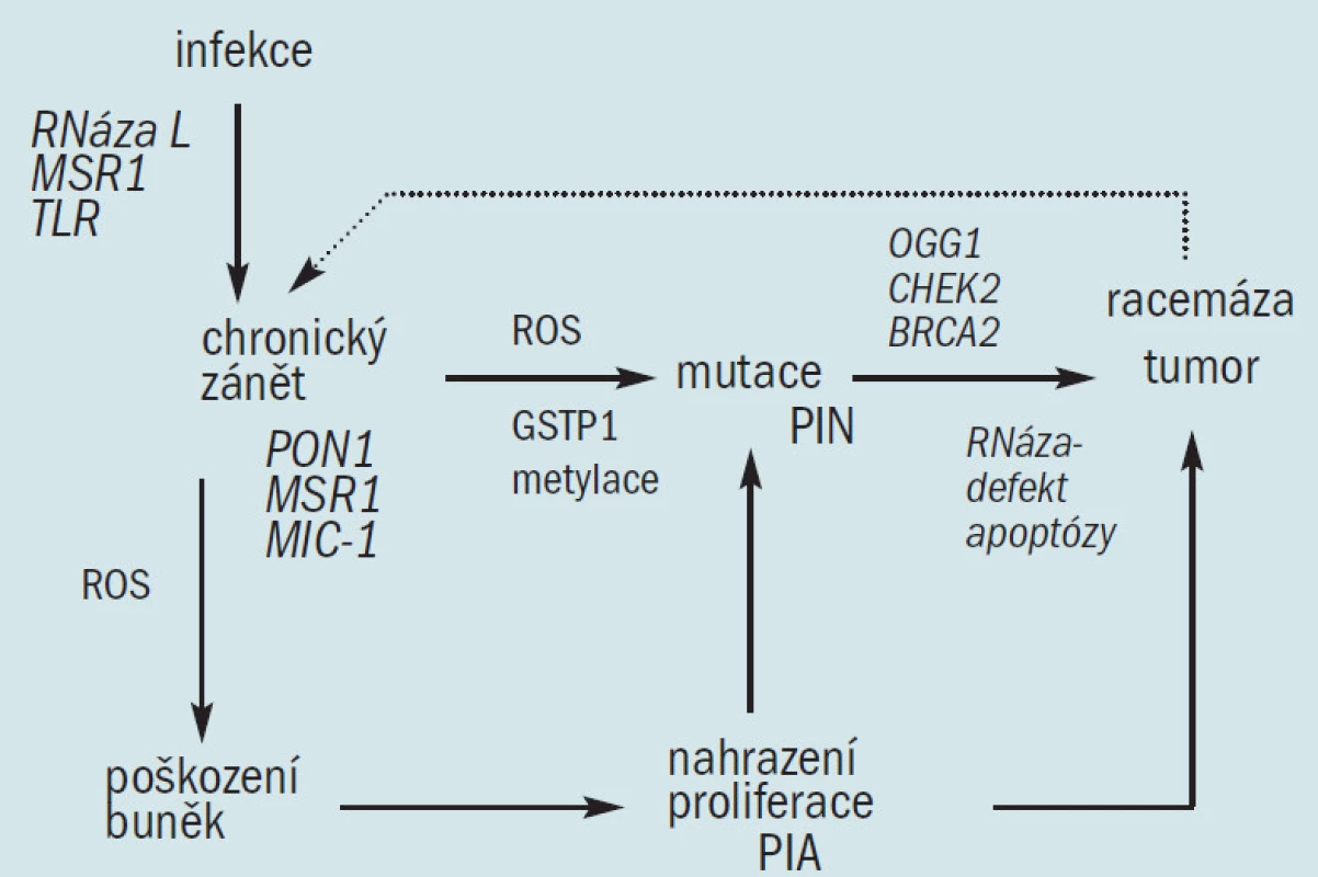 Model patogeneze karcinomu prostaty vázaný na genetickou náchylnost, infekci a chronický zánět. Některé varianty genů náchylnosti ke karcinomu prostaty predisponují k infekci a různé defekty buněčné obrany proti oxidačními stresu, vyvolaného infekcí a jinými zdroji, vedou k nahrazení hyperproliferace (histologicky manifestované jako PIA), mutacím (histologicky manifestované jako PIN) a ke vzniku karcinomu. Tento proces je pravděpodobně podpořen dalšími zdroji oxidačního stresu jako je dietní a environmentální vliv.
PIA = proliferative inflammatory atrophy/proliferační zánětlivá atrofie
PIN = prostate intraepithelial neoplasy/prostatická intraepiteliální neoplazie