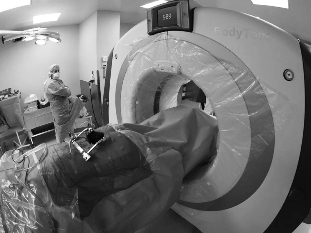 CT skener těsně před sejmutím intraoperačního obrazu
Fig. 1: The movable CT scanner just before taking the intraoperative scans