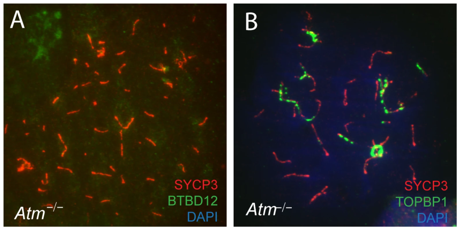 BTBD12 is down regulated in <i>Atm</i> null mice.