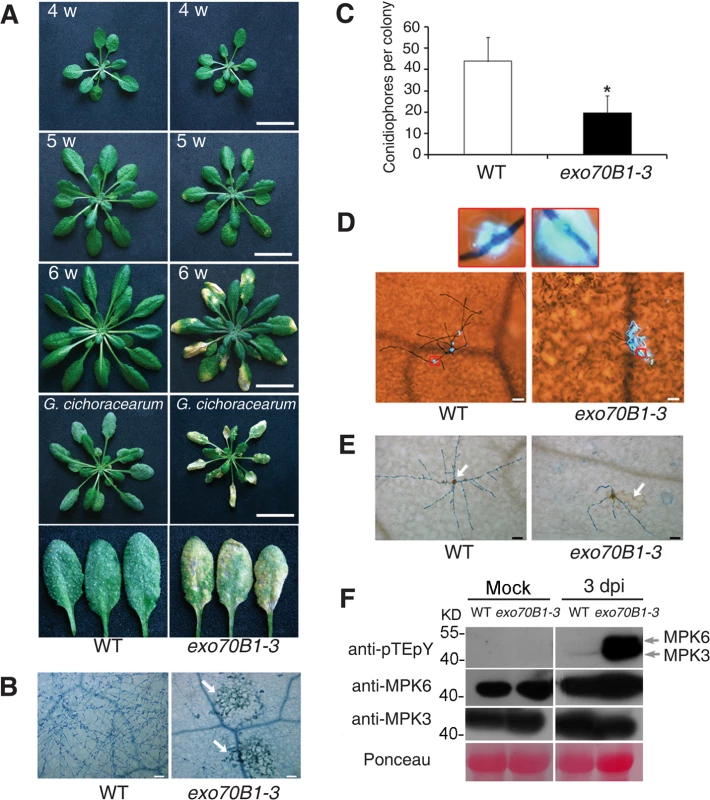 <i>exo70B1-3</i> mutants display enhanced resistance to <i>G. cichoracearum</i>.