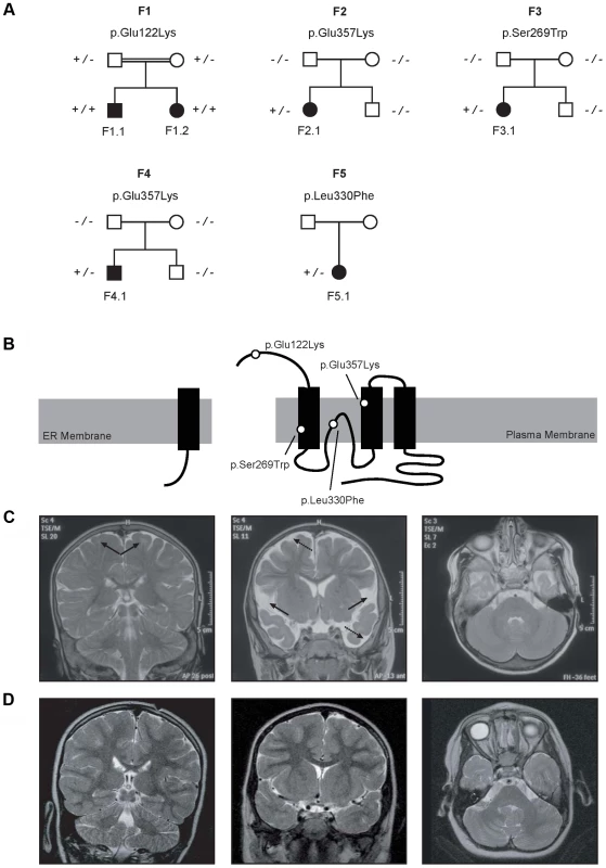 Pedigrees and magnetic resonance imaging (MRI) studies of families with primary hypomagnesemia.