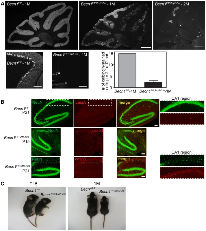 Loss of beclin 1 in selected neurons leads to rapid degeneration.
