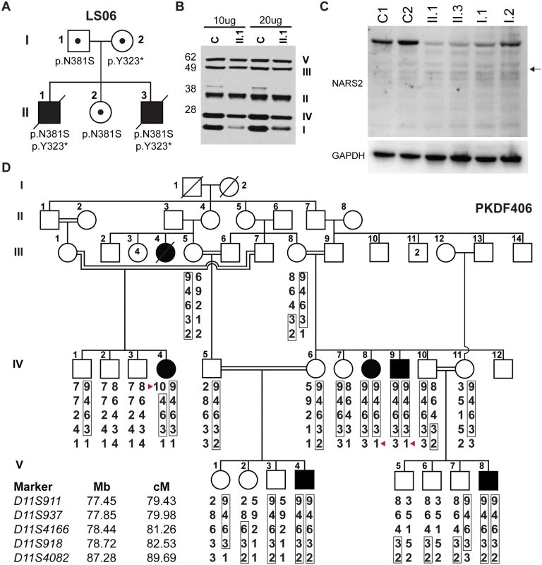 <i>NARS2</i> mutations identified in two unrelated families.