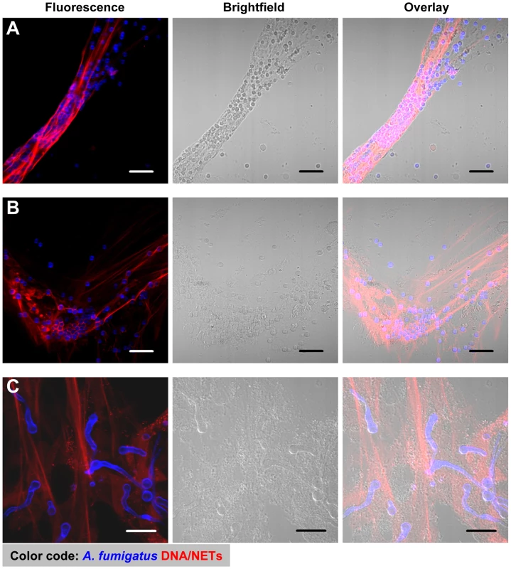 NET formation by human neutrophils co-incubated with resting and swollen conidia or hyphae of <i>A. fumigatus</i>.