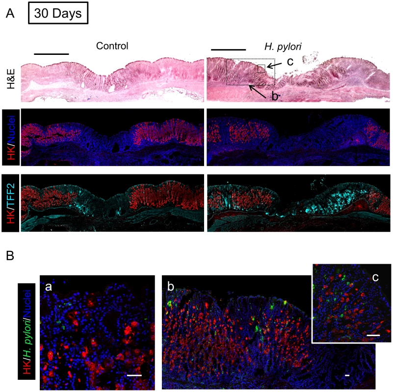 Morphology of gastric ulcerated tissue 30 days after <i>H. pylori</i> inoculation.