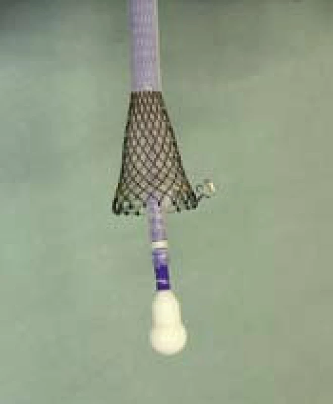 Distální konec zavaděče v první poloze po rozevření před insuflací balonku.
Fig. 5. Distal end of the applicator in the first position for opening before the balloon insufflation.