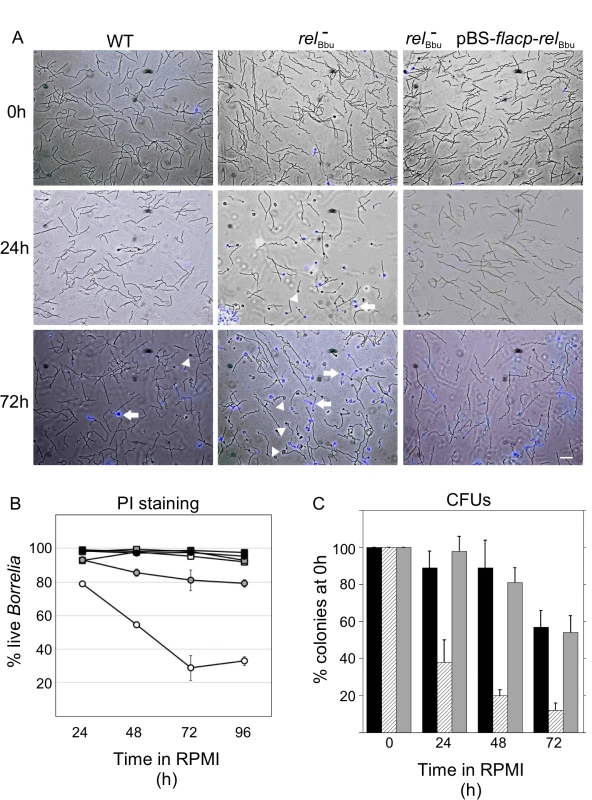 Survival of <i>B</i>. <i>burgdorferi</i> during starvation conditions <i>in vitro</i> depends on <i>rel</i><sub>Bbu</sub>.