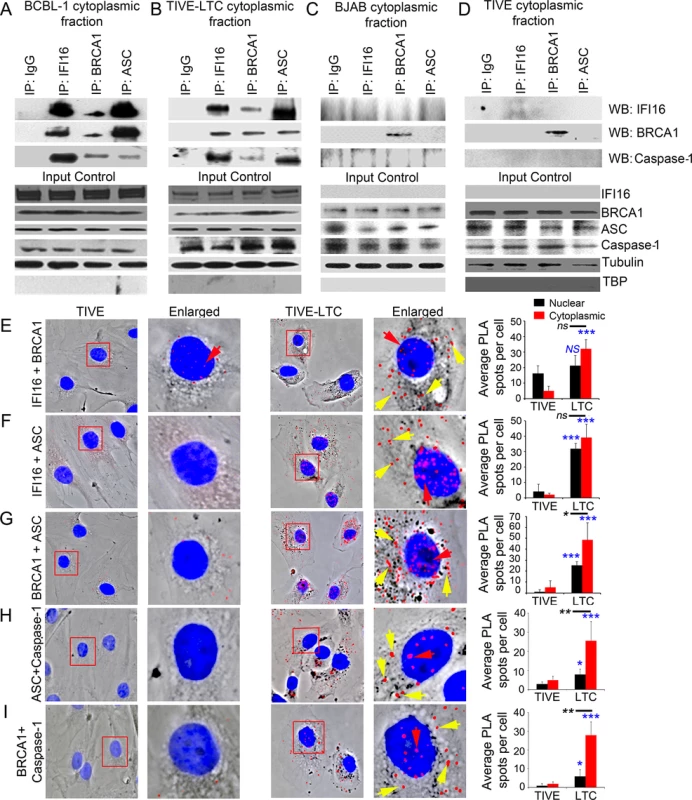 Analysis demonstrating BRCA1 is a member of the IFI16-inflammasome complex in cells latently infected with KSHV.