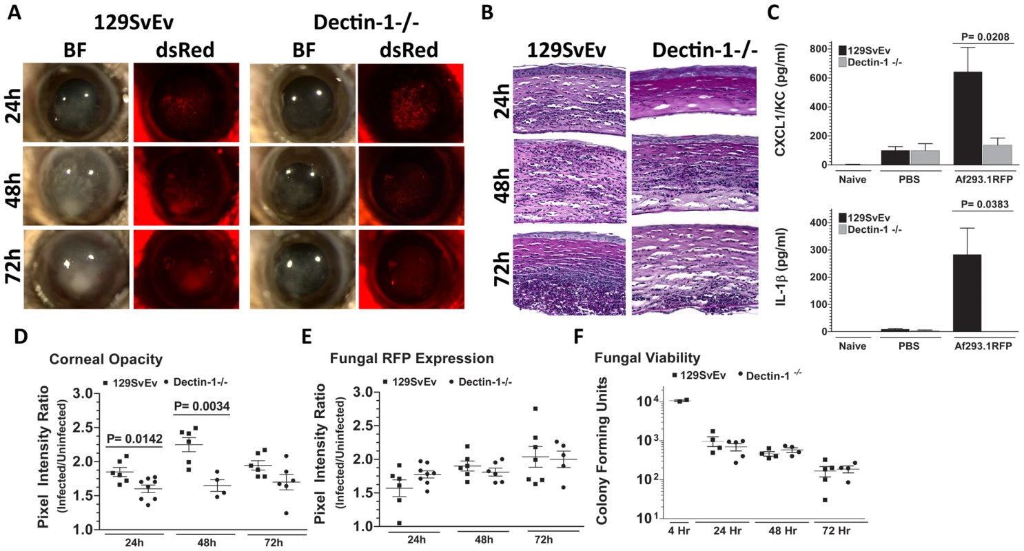 Role of Dectin-1 in keratitis caused by <i>A. fumigatus</i> Af293.1RFP.
