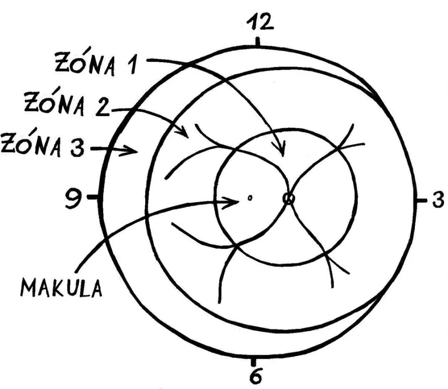 Zóny ROP