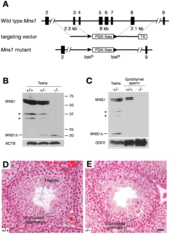 <i>Mns1</i> is required for spermiogenesis.