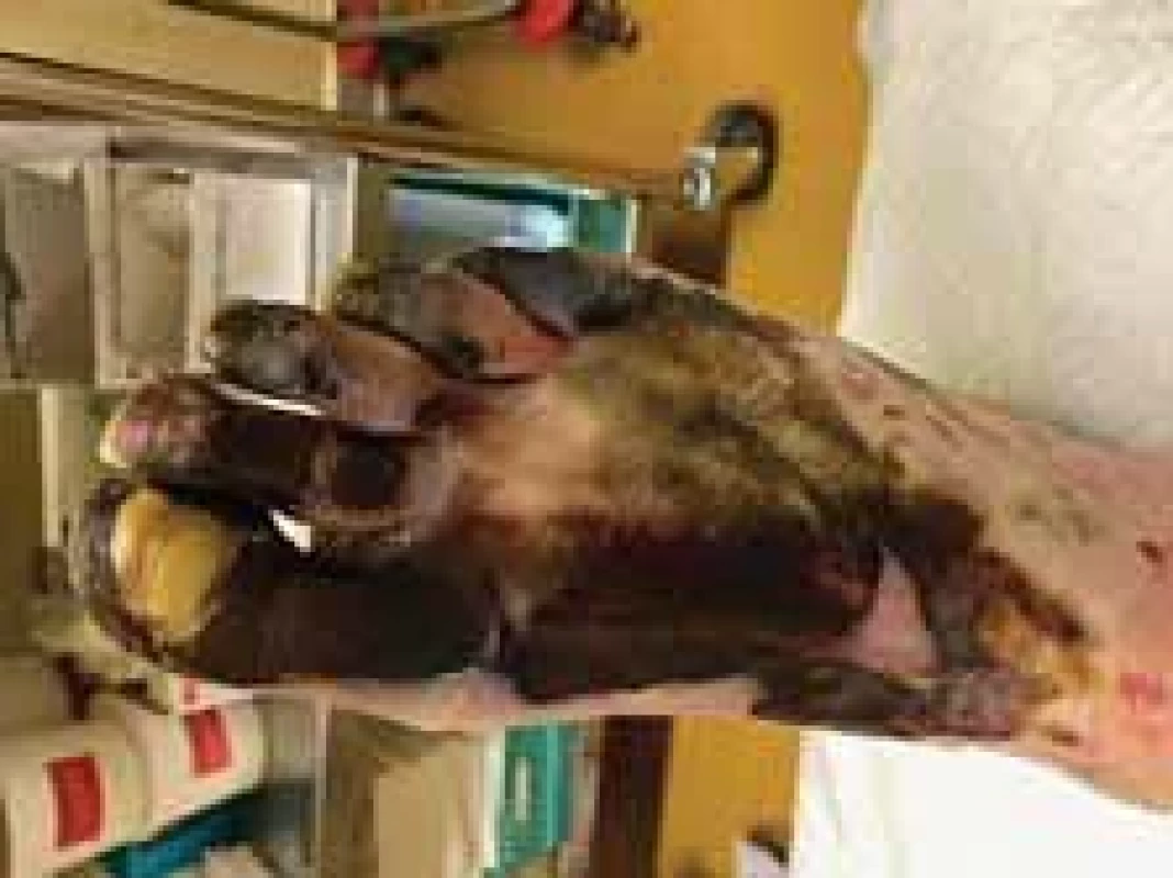 Appearance of right foot (dorsal view).