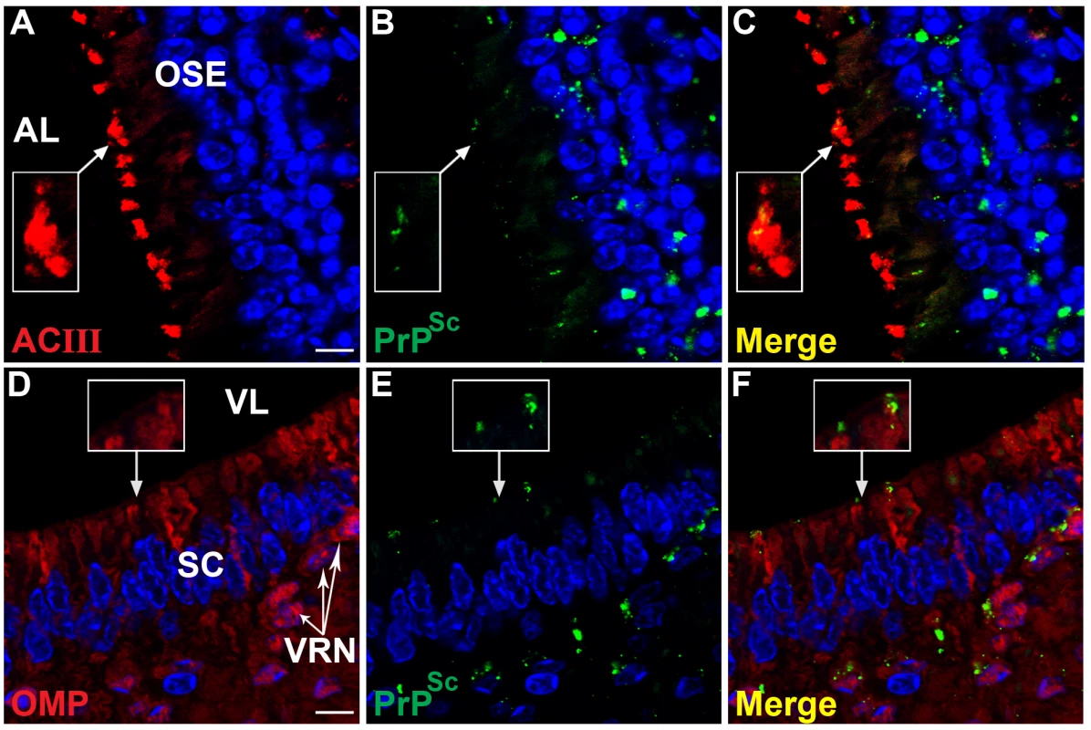 PrP<sup>Sc</sup> distribution at the border of airway lumen of the olfactory and vomeronasal sensory epithelium following intra-olfactory bulb inoculation of the HY TME agent.