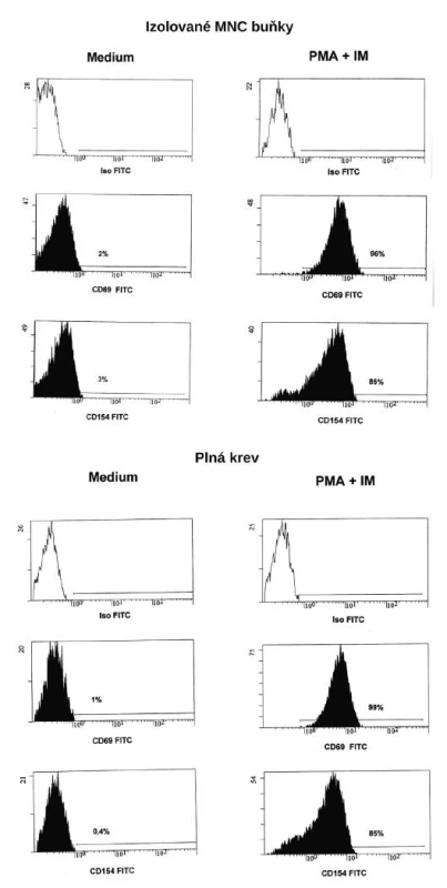 Vyšetření exprese CD154 na CD5+CD8- lymfocytech 3a) izolované buňky; 3b) plná krev
Fig. 3. Detection of CD154 expression on CD5+CD8- T cells 3a) Isolated cells ; 3b) Whole blood