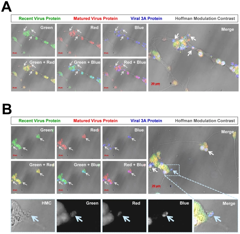 Colocalization of “fluorescent timer” protein and viral 3A protein in NPSCs infected with Timer-CVB3.