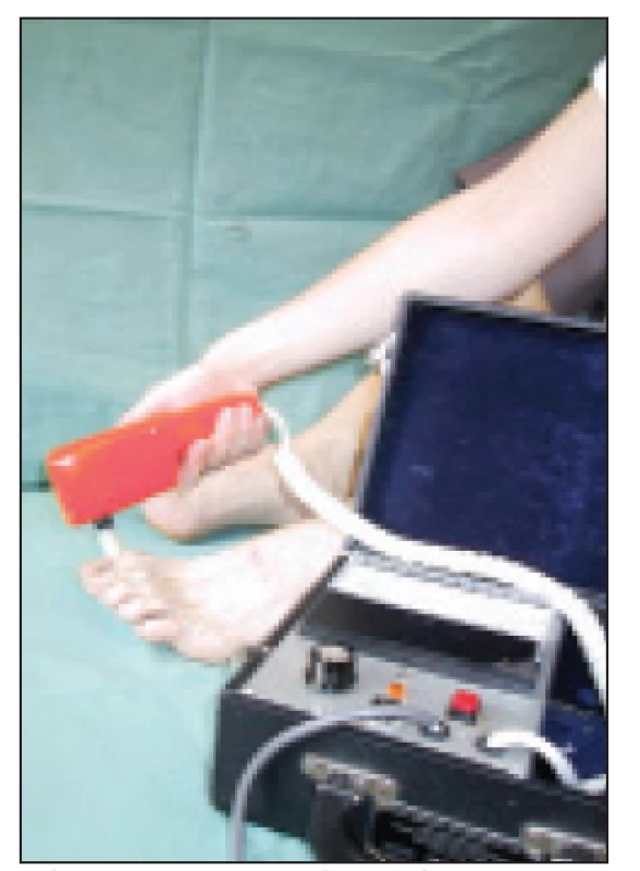 Vyšetření vibračního čití biothesiometrem.